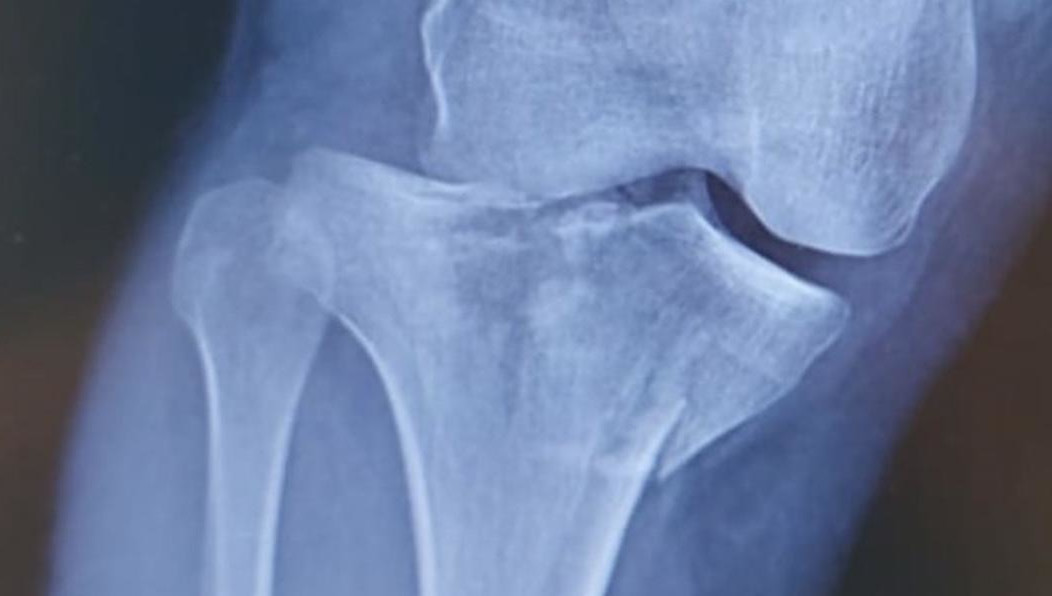 Более 30% людей