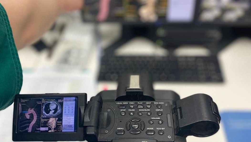 Пациент поступил к врачам в крайне тяжелом состоянии с разрывом аорты у основания и с 2