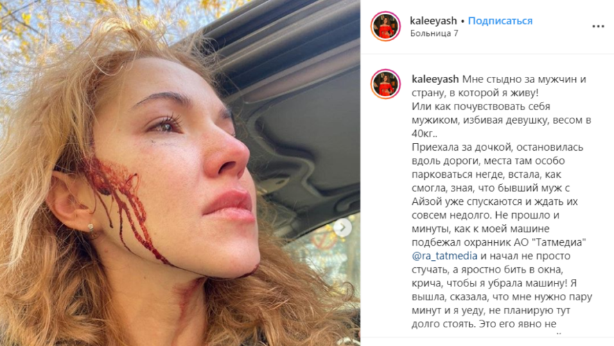 Руководство АО «Татмедиа» извинилось перед парикмахером Алией Акчуриной.