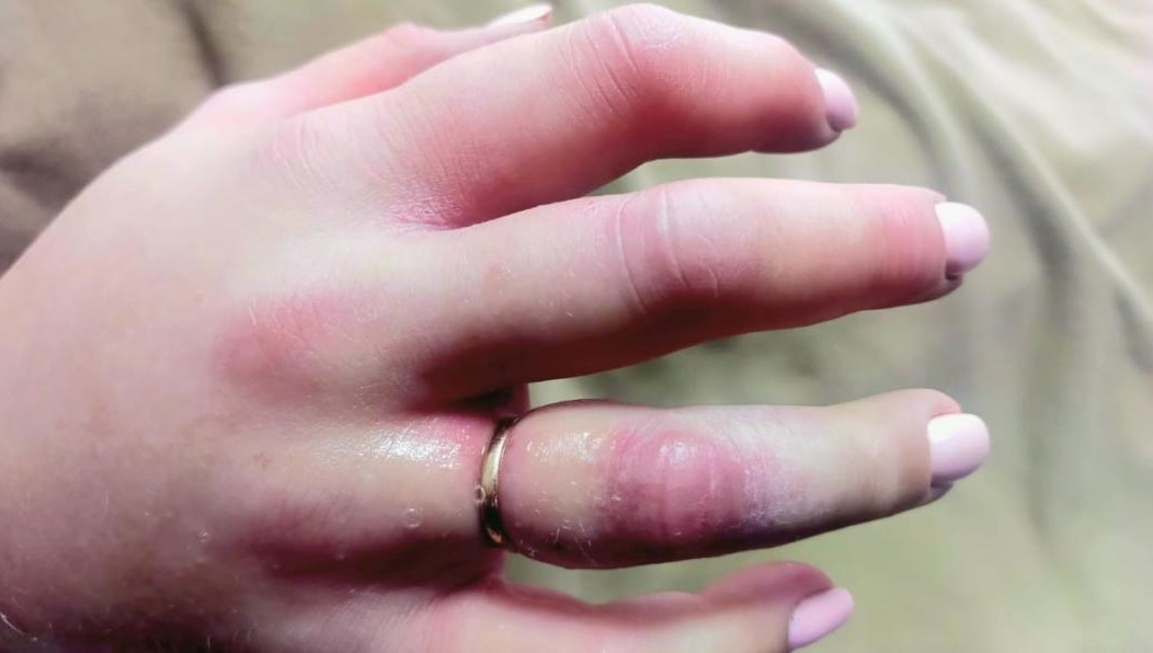 Медики привлекли спасателей