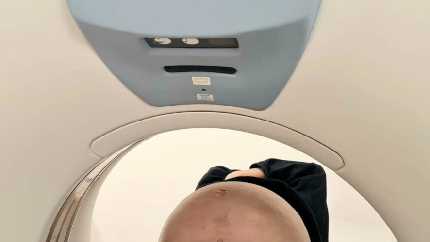 В брюшной полости мужчины скопилось около 10 литров жидкости.