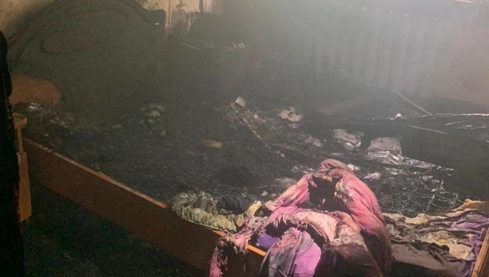 Его госпитализировали с ожогами.