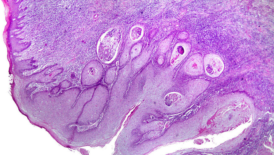 Он называется «цифровой биопсией».