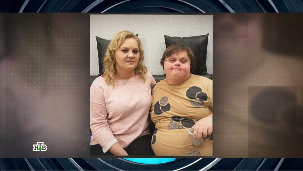 Одна из сестер появилась на свет здоровой