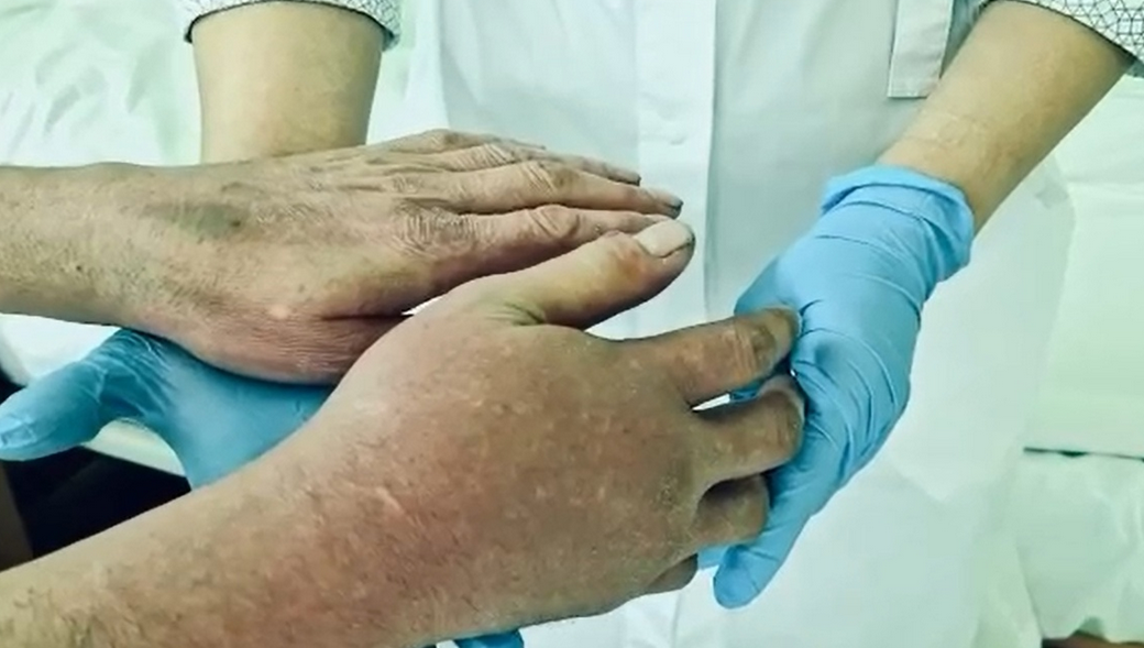 Мужчина не сразу обратился в больницу