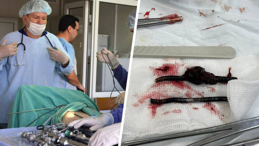 Мужчина сам вызвал скорую помощь и пожаловался на&nbsp;резкие боли в&nbsp;области живота