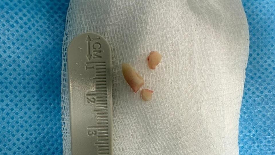 Ребенок ими поперхнулся.