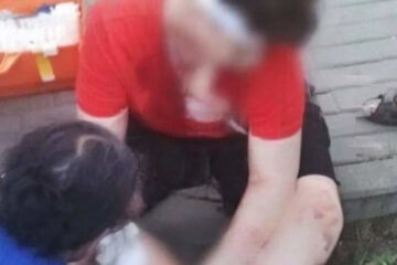 В тяжелом состоянии подростка доставили в НИИ неотложной детской хирургии и травматологии.